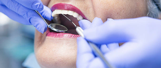 Best Chipped Tooth Repair Near Me  in , CO